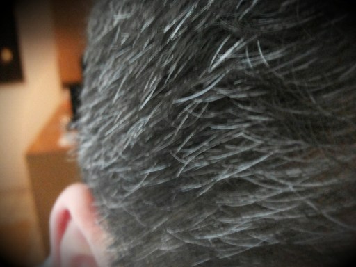 A prata que a preta têmpora assedia